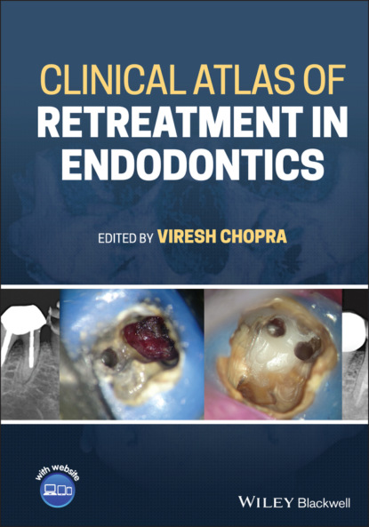 Скачать Clinical Atlas of Retreatment in Endodontics - Группа авторов