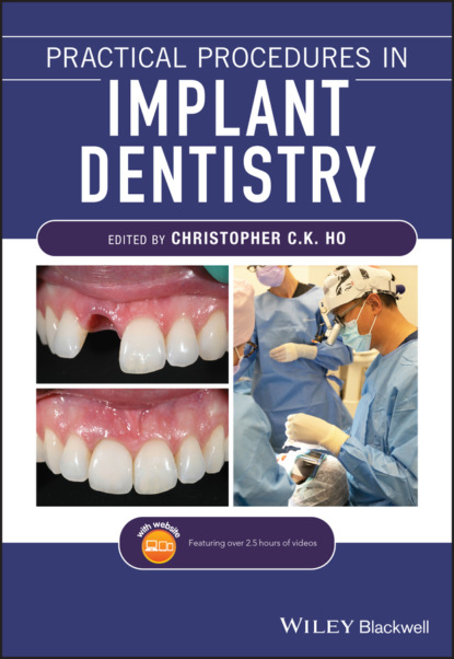 Скачать Practical Procedures in Implant Dentistry - Группа авторов