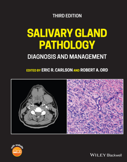 Скачать Salivary Gland Pathology - Группа авторов